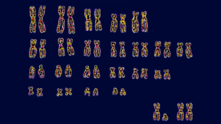 Karyotype